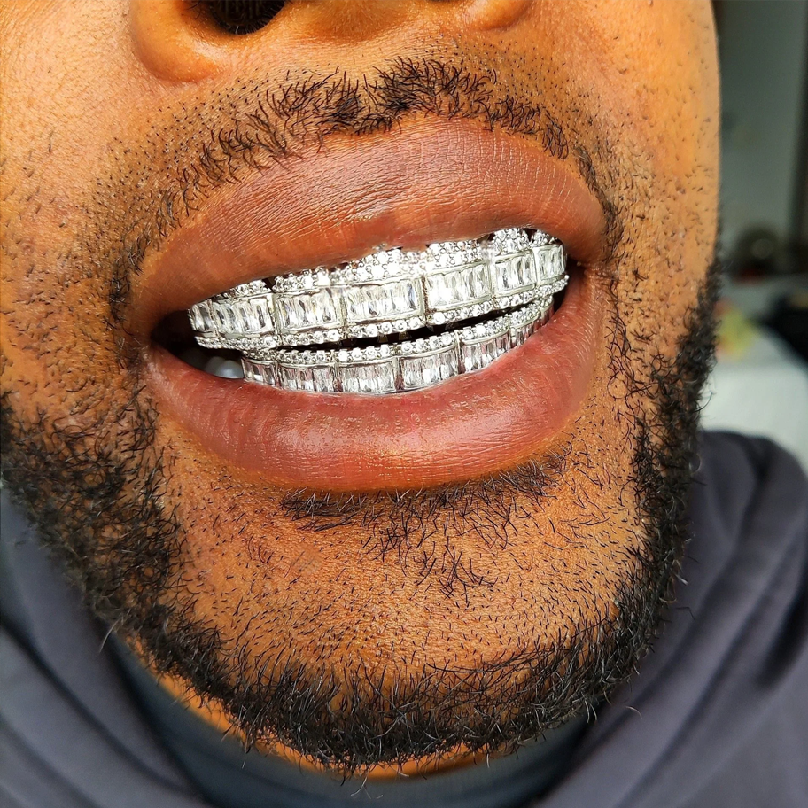 18K Gold Diamond & Baguette Grillz